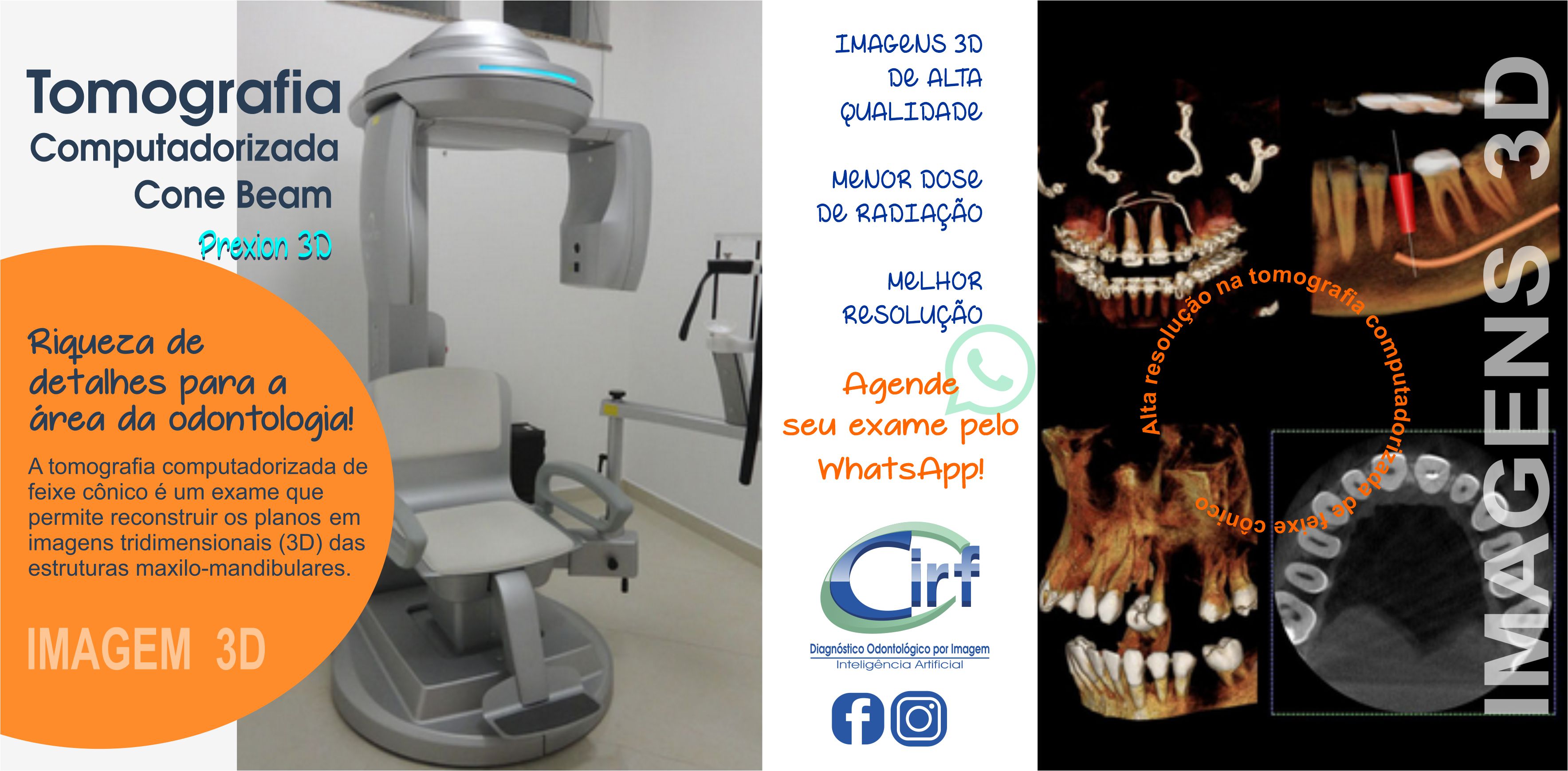 Cirf-Tomografia-Prexiom3D